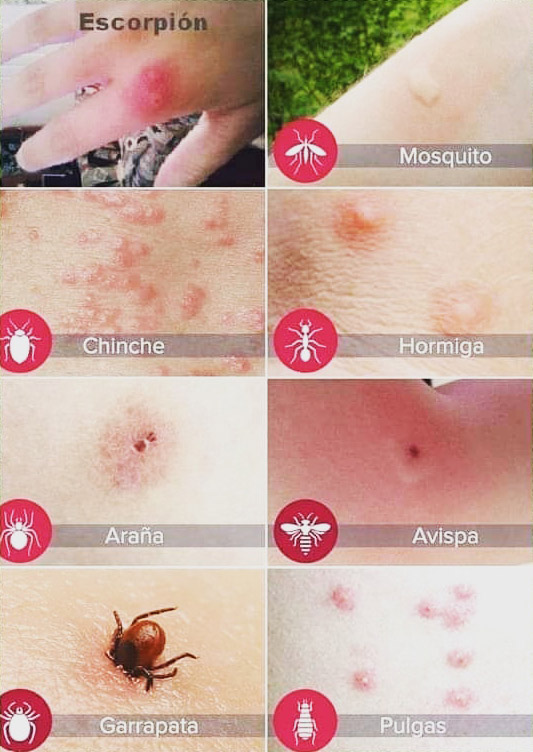 Cómo evitar las picaduras de mosquitos: mantén a raya a los insectos que pican